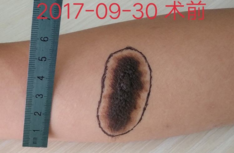 �ֲ�������ɫ����1