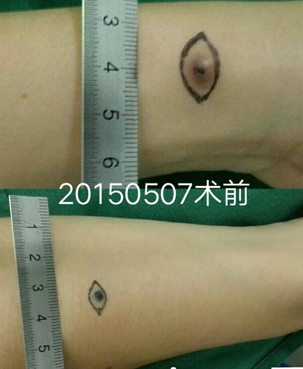 �ֲ�ɫ����2