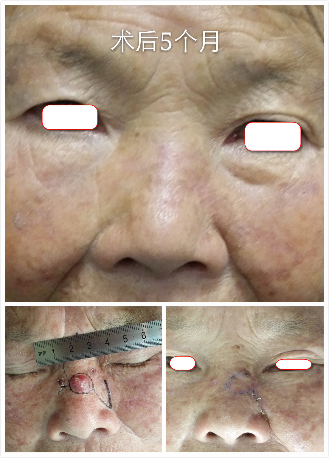 �Ǳ�����ϸ����