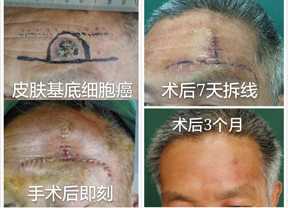 �����ϸ����