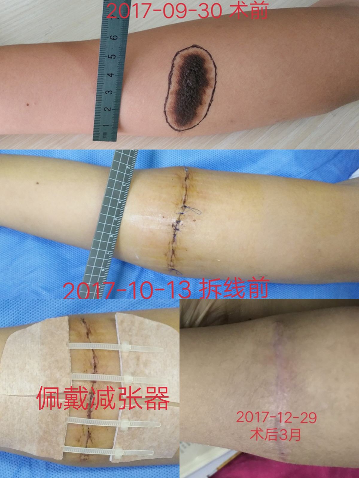 �ֱ������Ժ�ë��