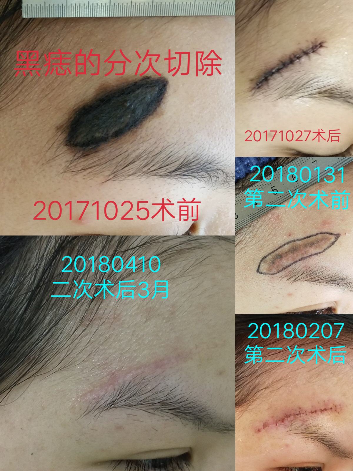 ���ķ�2���г�