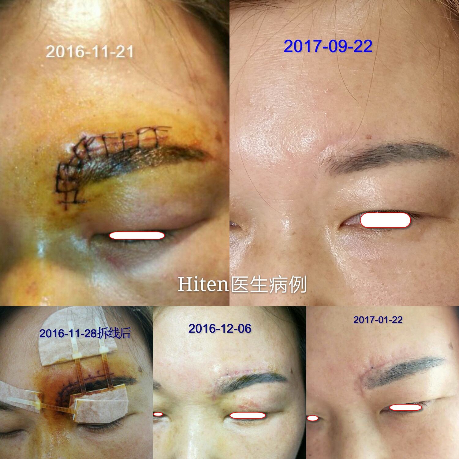 ü�����˼�����