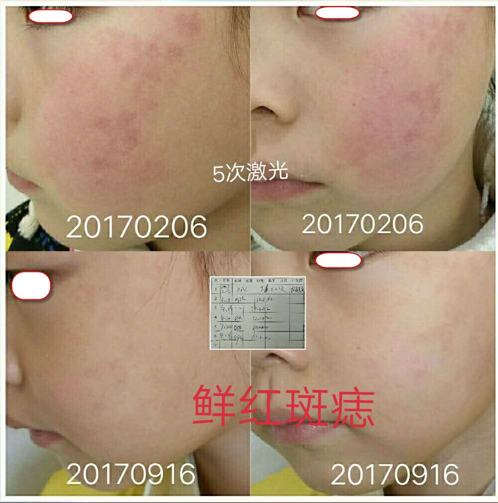 ���̱�ɽ���������ʺ����