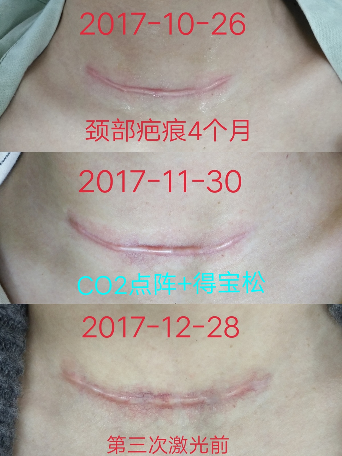 CO2���󼤹����ư̺�